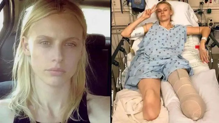 American model loses legs and almost dies despite proper tampon use! …Read more